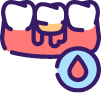 Icon of bleeding receding gums